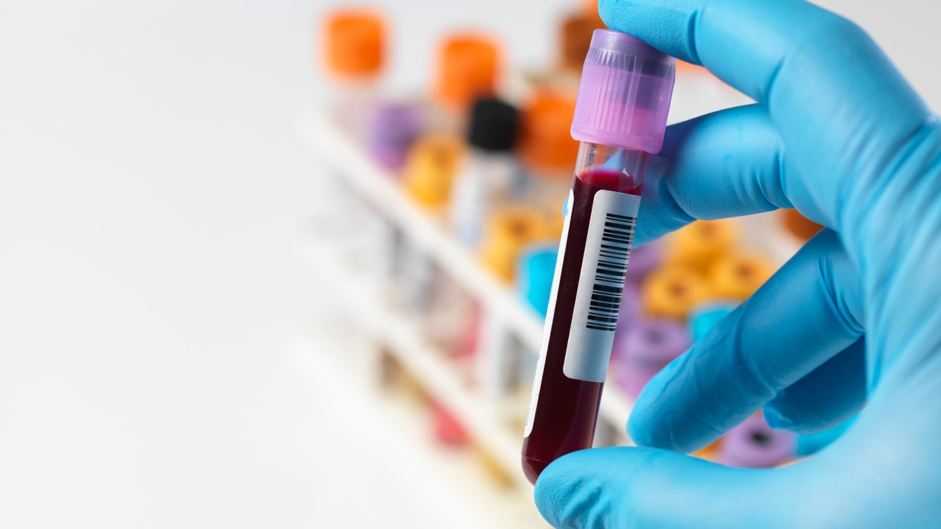 Hematology analyzer at Blufrog lab